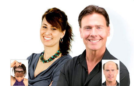 Hair Transplant Abroad - Hairdresser Find 2