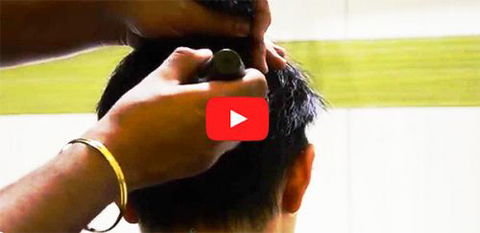 Hair Transplant Abroad - Hairdresser Find 4