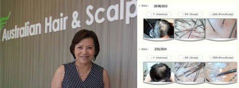 Australian Hair & Scalp Clinic - Hairdresser Find 1
