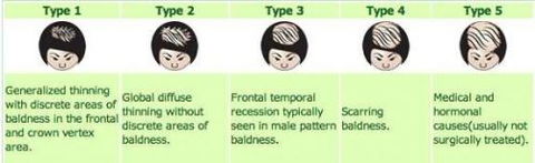 Australian Hair & Scalp Clinic - Hairdresser Find 2