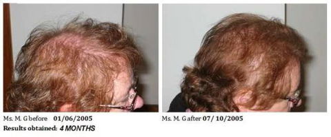 Australian Hair & Scalp Clinic - Hairdresser Find 7