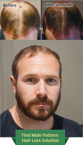 Australian Hair & Scalp Clinic - Hairdresser Find 8